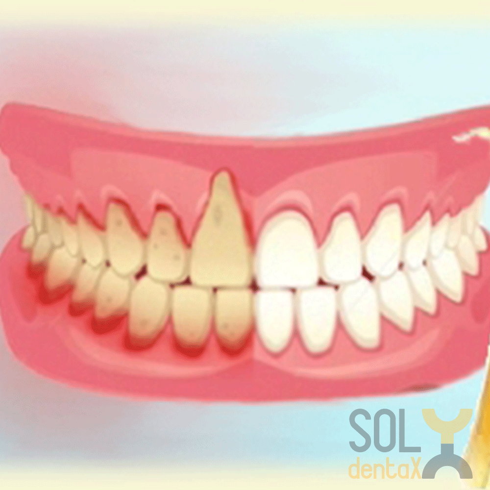 Parodontologie-Soldentax-buzau