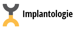 Implantologie-Buzau