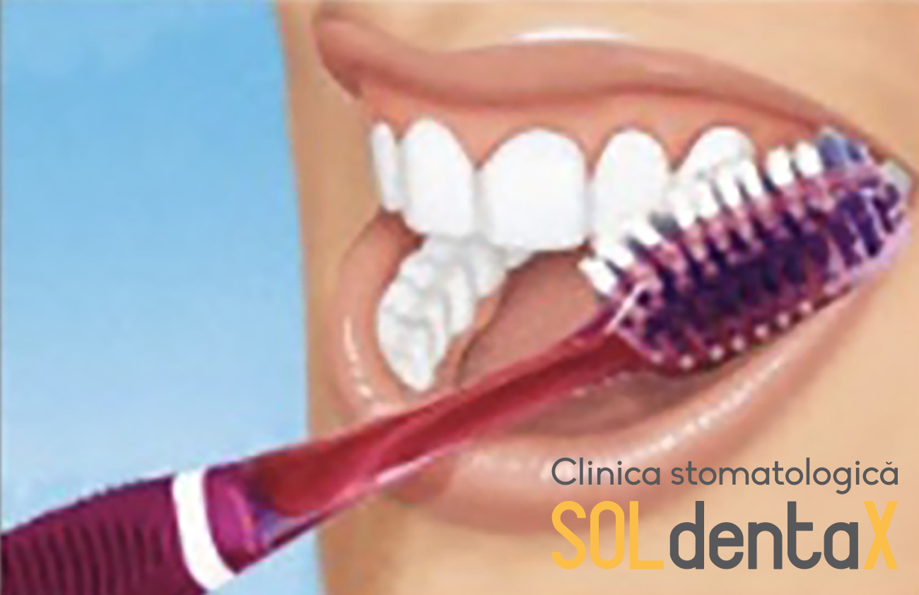 periaj dentar clinica stomatologica buzau 2