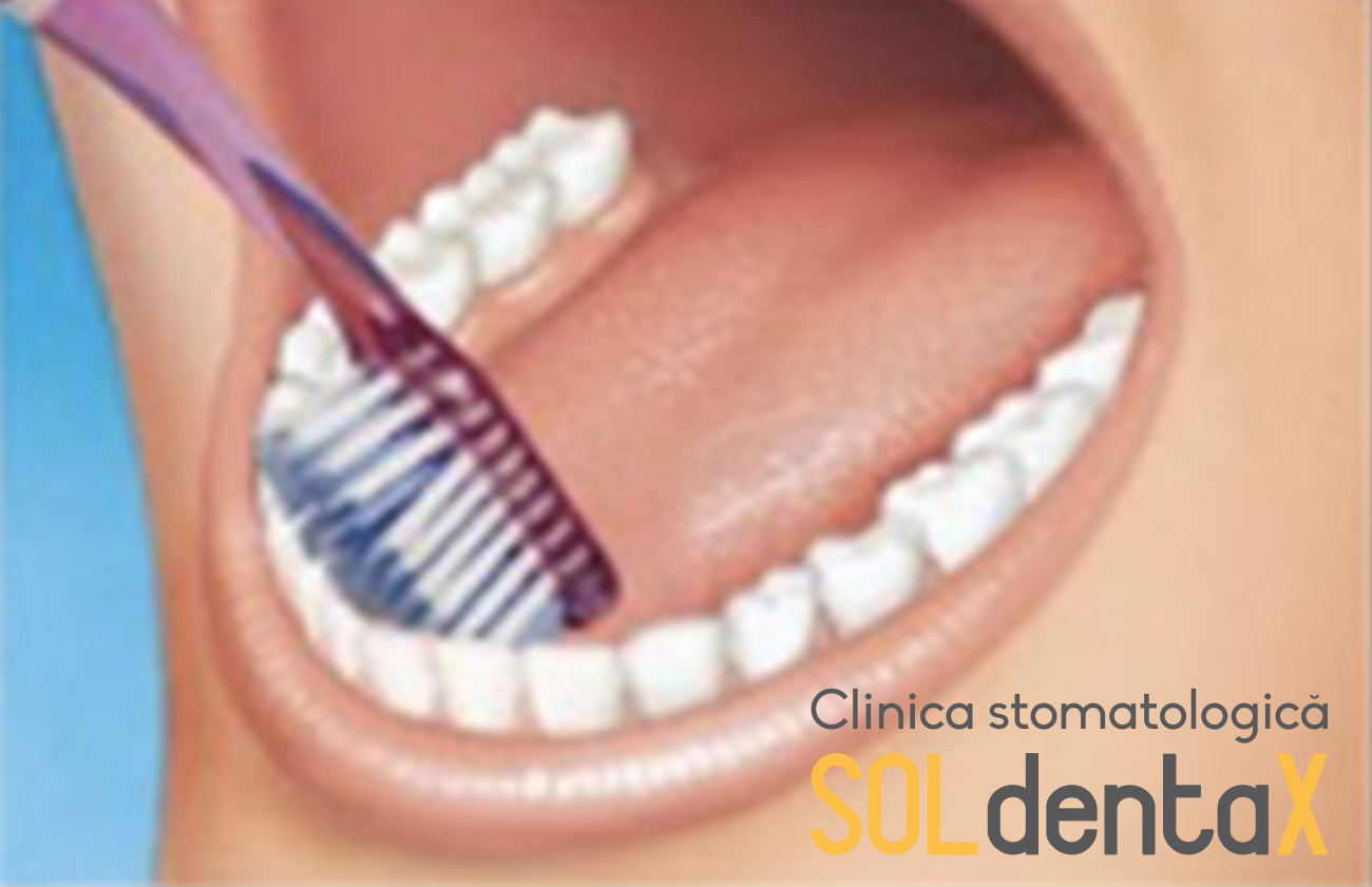 periaj dentar clinica stomatologica buzau 4