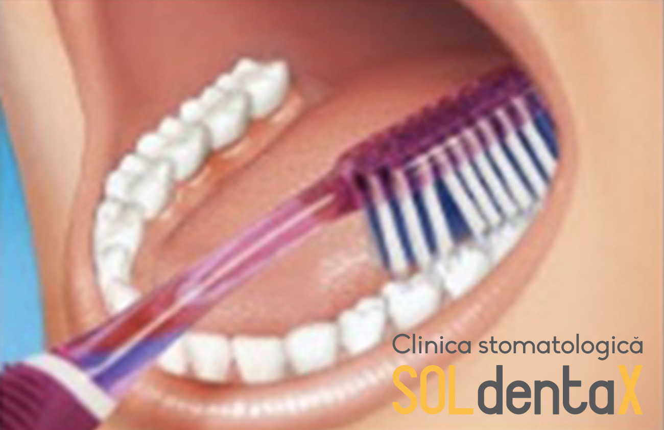 periaj dentar clinica stomatologica buzau 5